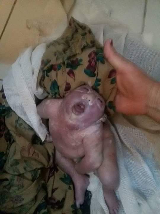 له‌ گه‌رمیان منداڵێكی بێ سه‌ر له‌ دایك ده‌بێت